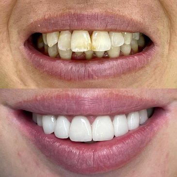 Slider image (3) Astra Dental Clinic